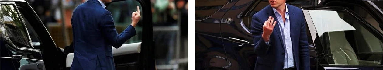 2 проекции рентгена